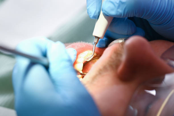 Best Emergency Treatment for Dental Infections or Abscesses in Highland Park, TX