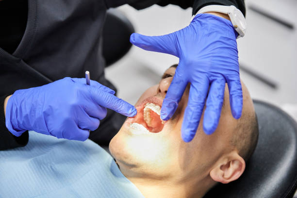 Best Emergency Dental Care for Broken or Chipped Teeth in Highland Park, TX