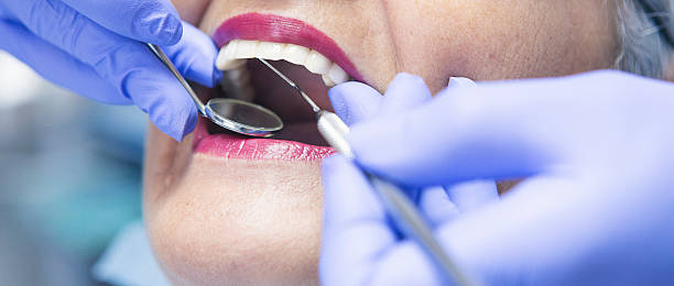 Best Emergency Treatment for Dental Infections or Abscesses in Highland Park, TX